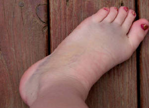 hollysfoot140.jpg