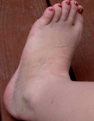 hollysfoot143.jpg